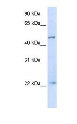 Transfected 293T cell lysate. Antibody concentration: 1.0 ug/ml. Gel concentration: 12%.