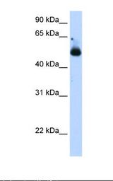 Transfected 293T cell lysate. Antibody concentration: 1.25 ug/ml. Gel concentration: 12%.