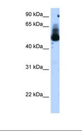 Transfected 293T cell lysate. Antibody concentration: 1.25 ug/ml. Gel concentration: 12%.