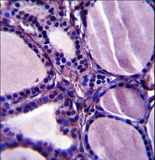 TRIM23 Antibody immunohistochemistry of formalin-fixed and paraffin-embedded human thyroid tissue followed by peroxidase-conjugated secondary antibody and DAB staining.