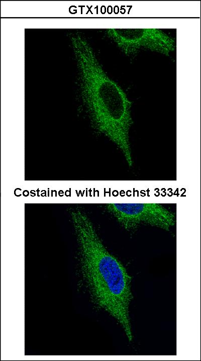 Confocal immunofluorescence analysis (Olympus FV10i) of paraformaldehyde-fixed HeLa using TRIM23 antibody (Green) at 1:500 dilution.