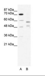 A: Marker, B: HepG2 Cell Lysate