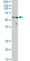 TRIM23 monoclonal antibody (M01), clone 2H4. Western Blot analysis of TRIM23 expression in A-431.