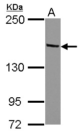 Sample (30 ug of whole cell lysate) A: HeLa 5% SDS PAGE TRIM24 antibody diluted at 1:1000