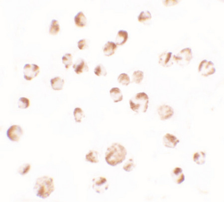 Immunocytochemistry of TRIM24 in EL4 cells with TRIM24 antibody at 2.5 ug/ml.