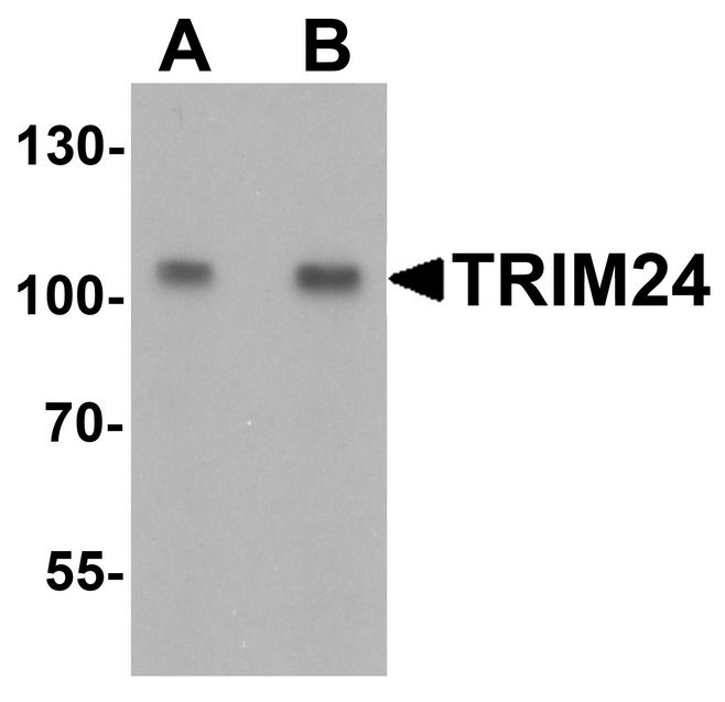 Western blot analysis of TRIM24 in EL4 cell lysate with TRIM24 antibody at (A) 0.5 and (B) 1 ug/ml.