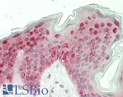 Human Skin: Formalin-Fixed, Paraffin-Embedded (FFPE)