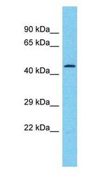 TRIM25 antibody Western Blot of Breast tumor. Antibody dilution: 1 ug/ml.