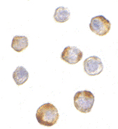 Immunocytochemistry of TRIM25 in HeLa cells with TRIM25 antibody at 5 µg/ml.