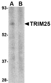Western blot of TRIM25 in human thymus tissue lysate in (A) the absence and (B) absence of blocking peptide with TRIM25 antibody at 1 ug/ml.