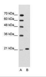 A: Marker, B: Jurkat Cell Lysate