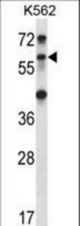 TRIM27 Antibody western blot of K562 cell line lysates (35 ug/lane). The TRIM27 antibody detected the TRIM27 protein (arrow).