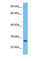 Western blot of TMED7 Antibody with human Ovary Tumor lysate.
