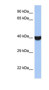 TMED8 antibody LS-C111779 Western blot of Jurkat lysate.