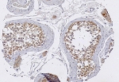 Immunohistochemical staining with anti-TRIM29 antibody in normal testis tissue at 1:100 dilution.