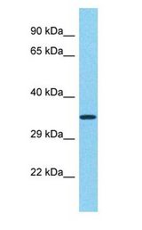TRIM29 antibody Western Blot of Lung tumor. Antibody dilution: 1 ug/ml.