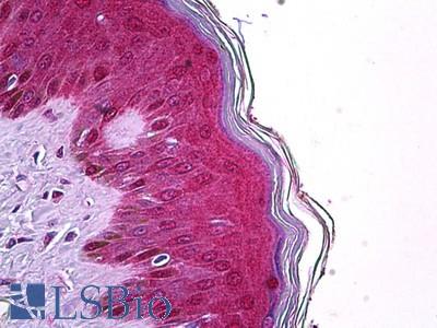 Anti-TRIM29 antibody IHC of human skin. Immunohistochemistry of formalin-fixed, paraffin-embedded tissue after heat-induced antigen retrieval. Antibody LS-B5943 concentration 3.75 ug/ml.