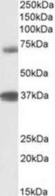 TRIM29 antibody (1 ug/ml) staining of Peripheral Blood Lymphocytes lysate (35 ug protein/ml in RIPA buffer). Primary incubation was 1 hour. Detected by chemiluminescence.