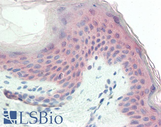 Anti-TRIM29 antibody IHC staining of human skin. Immunohistochemistry of formalin-fixed, paraffin-embedded tissue after heat-induced antigen retrieval. Antibody LS-B10307 concentration 5 ug/ml.