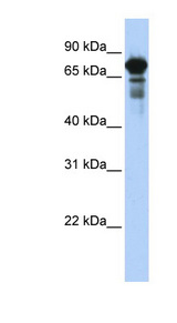 TRIM29 antibody Western blot of Transfected 293T cell lysate.
