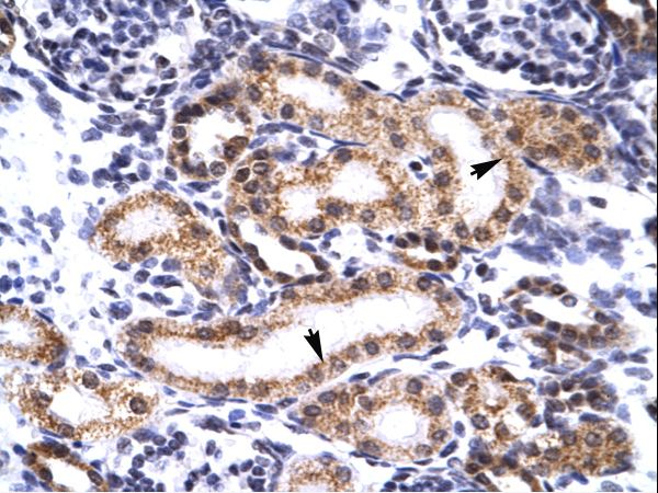 TRIM3 antibody LS-C31401 was used in IHC to stain formalin-fixed, paraffin-embedded human kidney.