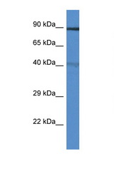TRIM3 antibody LS-C145487 Western blot of Mouse Heart lysate. Antibody concentration 1 ug/ml.