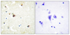 IHC of paraffin-embedded human brain tissue, using TRIM3 Antibody. The picture on the right is treated with the synthesized peptide.