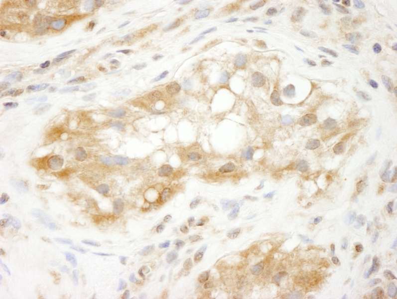FFPE section of human testis. LS-C286489 used at a dilution of 1:250.