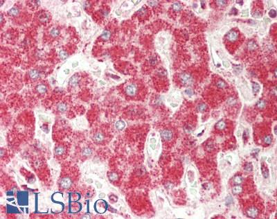 Human Liver: Formalin-Fixed, Paraffin-Embedded (FFPE)