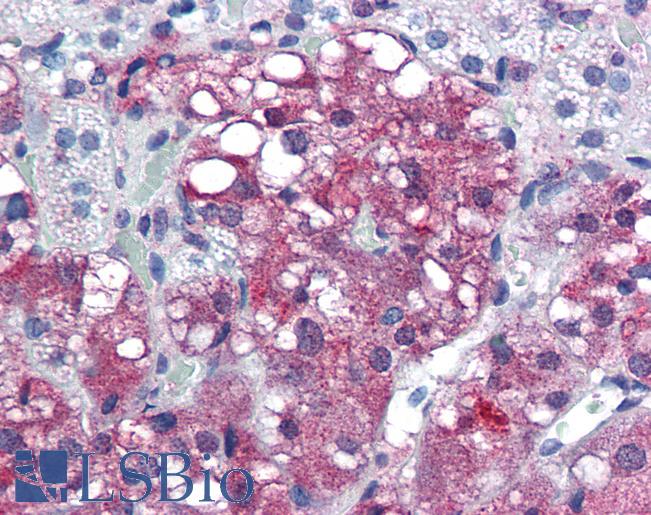 Anti-TRIM3 antibody IHC of human adrenal. Immunohistochemistry of formalin-fixed, paraffin-embedded tissue after heat-induced antigen retrieval. Antibody LS-B2870 concentration 5 ug/ml.