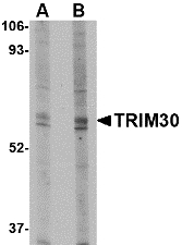 Western blot of TRIM30 in mouse heart tissue lysate with TRIM30 antibody at (A) 1 and (B) 2 ug/ml.