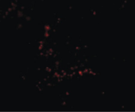 Immunofluorescence of TRIM30 in Human Ovary cells with TRIM30 antibody at 20 ug/ml.