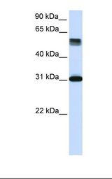 Fetal lung lysate. Antibody concentration: 1.0 ug/ml. Gel concentration: 12%.