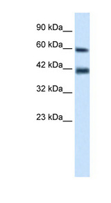 TRIM31 antibody LS-B1104 Western blot of Jurkat lysate.