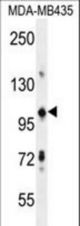 TRIM33 Antibody western blot of MDA-MB435 cell line lysates (35 ug/lane). The TRIM33 antibody detected the TRIM33 protein (arrow).