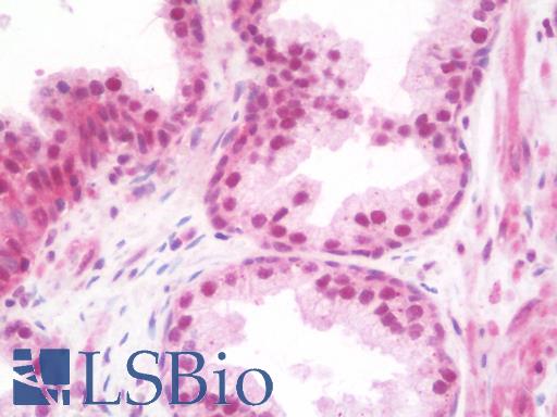 Anti-TRIM33 / TIF1-Gamma antibody IHC staining of human prostate. Immunohistochemistry of formalin-fixed, paraffin-embedded tissue after heat-induced antigen retrieval. Antibody LS-B10115 concentration 10 ug/ml.