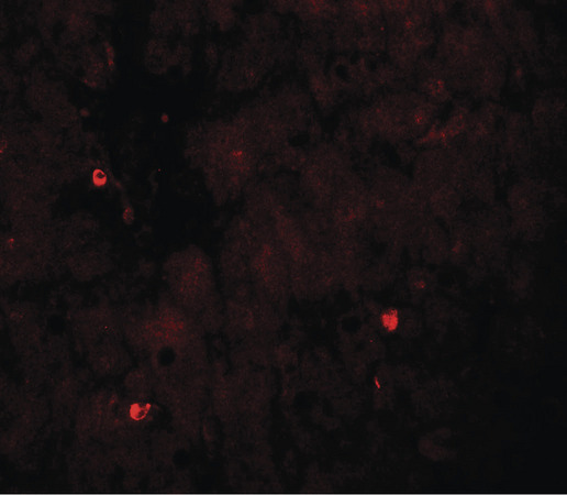 Immunofluorescence of TRIM33 in human liver tissue with TRIM33 antibody at 20 ug/ml.