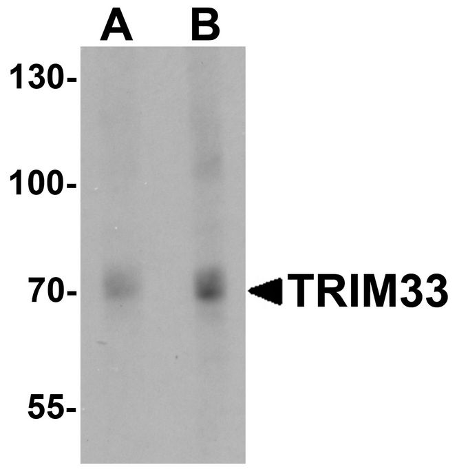 Western blot analysis of TRIM33 in human liver tissue lysate with TRIM33 antibody at (A) 1 and (B) 2 ug/ml.