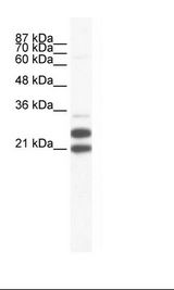 Jurkat Cell Lysate
