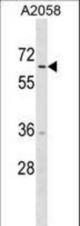 TRIM35 Antibody western blot of A2058 cell line lysates (35 ug/lane). The TRIM35 antibody detected the TRIM35 protein (arrow).