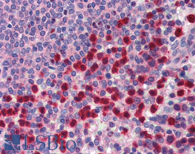 Anti-TRIM35 antibody IHC of human spleen. Immunohistochemistry of formalin-fixed, paraffin-embedded tissue after heat-induced antigen retrieval. Antibody LS-B3509 concentration 5 ug/ml.