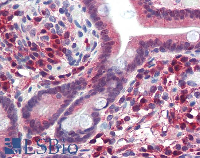 Anti-TRIM35 antibody IHC of human small intestine. Immunohistochemistry of formalin-fixed, paraffin-embedded tissue after heat-induced antigen retrieval. Antibody LS-B3509 concentration 5 ug/ml.