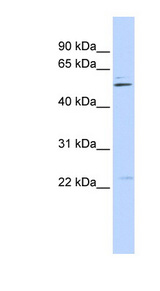 TRIM35 antibody LS-B3509 Western blot of HeLa lysate.