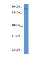 TRIM36 antibody LS-C145207 Western blot of Rat Lung lysate. Antibody concentration 1 ug/ml.