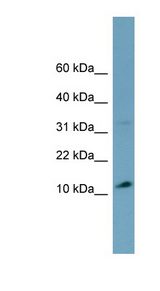 TRIM36 antibody LS-C110739 Western blot of OVCAR-3 cell lysate.