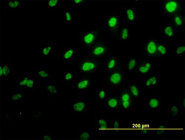 Immunofluorescence of monoclonal antibody to TRIM36 on HeLa cell. [antibody concentration 10 ug/ml]