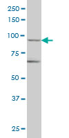 TRIM36 monoclonal antibody (M01), clone 2D11 Western blot of TRIM36 expression in IMR-32.