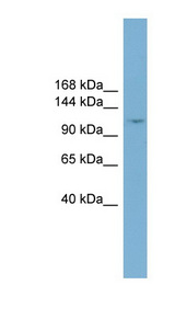 TRIM37 antibody LS-C110732 Western blot of PANC1 cell lysate.