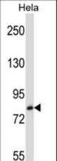 TRIM37 Antibody western blot of HeLa cell line lysates (35 ug/lane). The TRIM37 antibody detected the TRIM37 protein (arrow).