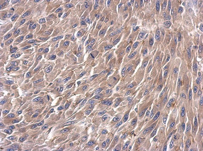 IHC of paraffin-embedded U87 xenograft using TRIM37 antibody at 1:500 dilution.